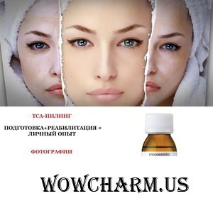 ТСА-ПИЛИНГ. ПОДГОТОВКА+РЕАБИЛИТА ЦИЯ= ЛИЧНЫЙ ОПЫТ. ФОТОГРАФИИ