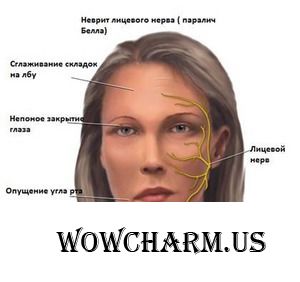 4 минуты для лица. Упражнения для лица после паралича Белла.